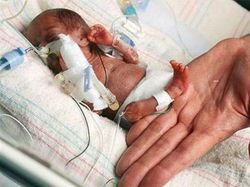 Melihat Potret Benda Hingga Makhluk Hidup Terkecil di Dunia