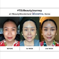 Titi DJ berangkat ke Korea Selatan sendirian dan menjalani prosedur operasi plastik pada Januari 2023. Foto: Instagram/@ti2dj