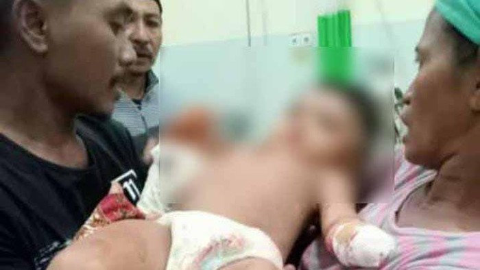 Bocah di Sampang tangannya putus kena mesin rajang tembakau.