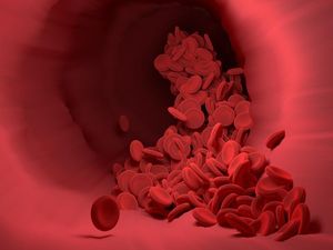 Hematoma: Jenis, Penyebab, Gejala, serta Cara Mengobati dan Mencegahnya
