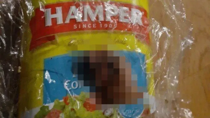 Jijik! 4 Orang Ini Tak Sengaja Temukan Potongan Jari Manusia di Makanan