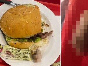 Jijik! 4 Orang Ini Tak Sengaja Temukan Potongan Jari Manusia di Makanan