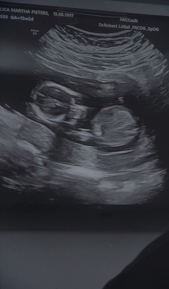 Penyanyi Runner Up ajang pencarian bakat Idola Cilik tahun 2016, Angel Pieters, baru saja mengumumkan kabar kehamilannya. Melalui akun Instagram pribadinya, Angel memperlihatkan video yang berisi foto USG, test pack, dan penampilannya kini dengan babybump yang sudah jelas terlihat. Foto: Instagram/@angelpieters