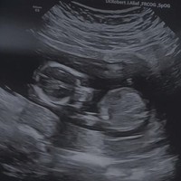 Penyanyi Runner Up ajang pencarian bakat Idola Cilik tahun 2016, Angel Pieters, baru saja mengumumkan kabar kehamilannya. Melalui akun Instagram pribadinya, Angel memperlihatkan video yang berisi foto USG, test pack, dan penampilannya kini dengan babybump yang sudah jelas terlihat. Foto: Instagram/@angelpieters