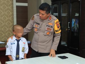 Penampakan Rambut Siswa di Samosir Dicukur Gurunya Sampai Setengah Botak
