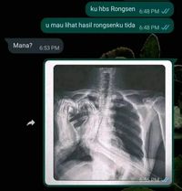 Chat Kocak Nanya Temen, Nggak Ada Yang Bener