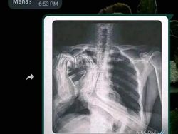 Chat Kocak Nanya Temen, Nggak Ada yang Bener