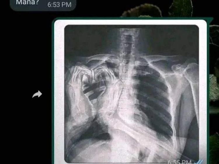Chat Kocak Nanya Temen, Nggak Ada yang Bener