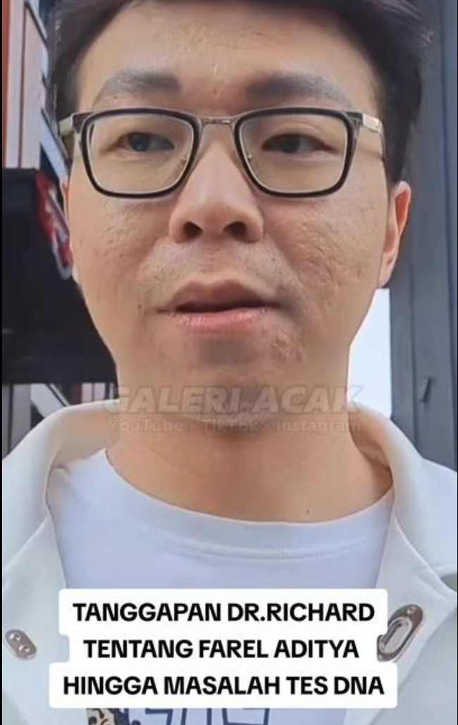 Walaupun saat ini wajahnya belum benar-benar mulus, namun diakui sang dokter wajahnya kini sudah jauh lebih sehat dibandingkan dengan wajahnya dahulu. Bopeng di wajahnya pun sudah banyak berkurang. Foto: TikTok/@galeri.acak