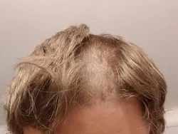 Potret Kesialan yang Dialami Warganet, Bikin Ngelus Dada