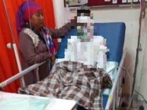 Dua Karyawan SPBU di Pasuruan Terbakar Saat Bersihkan Tangki Pendam
