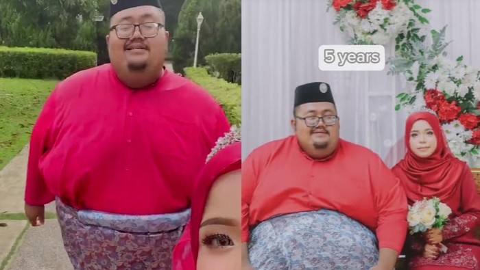 Awal Mula Viral Perjuangan Istri Dampingi Suami yang Obesitas, Bobotnya 300 Kg