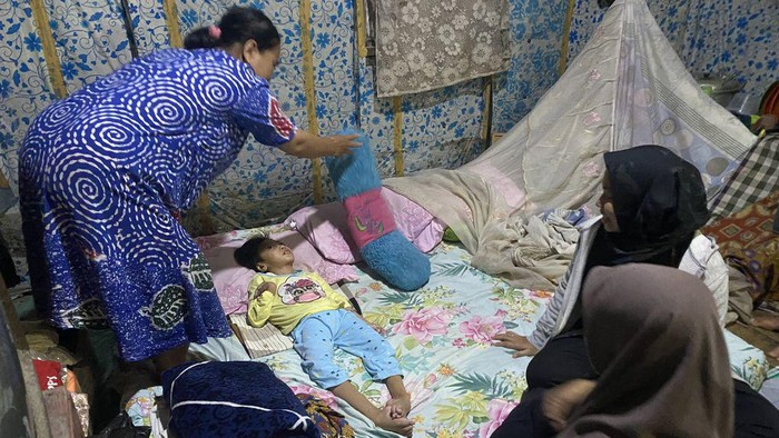 Apriliana, penderita Microsepalus yang kondisi kepalanya lebih kecil dari anak seusianya.