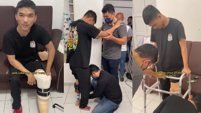 Jangan Anggap Sepele! Ciri Luka Diabetes Seperti Ini Bisa Berujung Amputasi Kaki