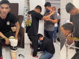 Jangan Anggap Sepele! Ciri Luka Diabetes Seperti Ini Bisa Berujung Amputasi Kaki