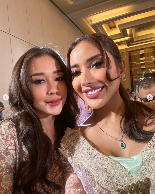 Beberapa waktu lalu Millen memang diketahui telah melakukan operasi hidung yang ke-4 di Thailand. Setelah operasi itu paras Millen pun jadi terlihat berubah. Foto: Instagram/@millencyrus