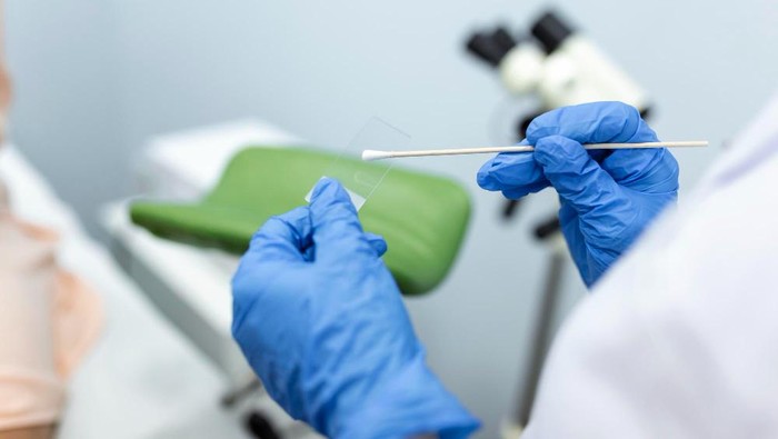 Pap Smear Adalah: Ketahui Syarat, Biaya, Prosedur, dan Efek Samping