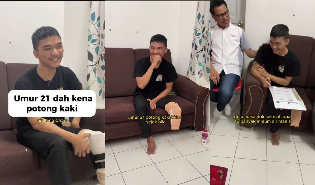 Viral pria 21 tahun kena diabetes