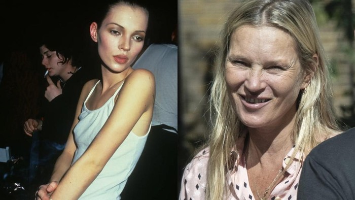 Kate Moss Disebut Lebih Tua, Dokter Singgung Kaitan Kolagen Menyusut Imbas Rokok