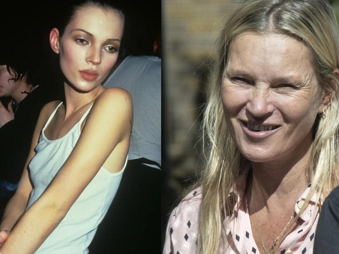 Penampilan Kate Moss yang disebut pudar karena kebiasaan merokok.