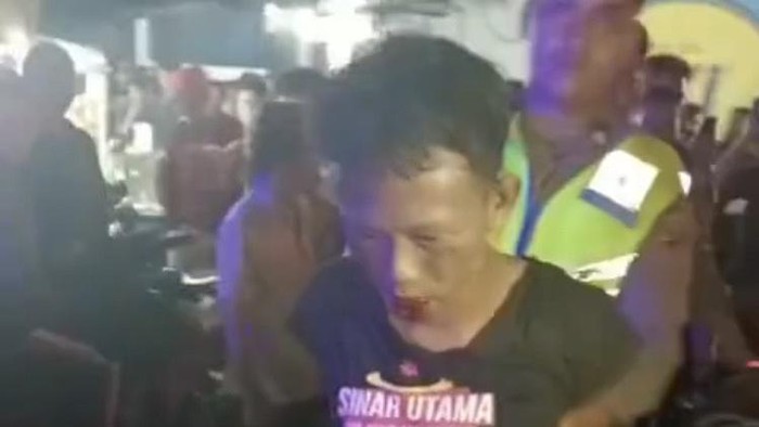 Wajah pelaku yang babak belur usai diamuk warga dan ditahan polisi. (Foto: Istimewa)