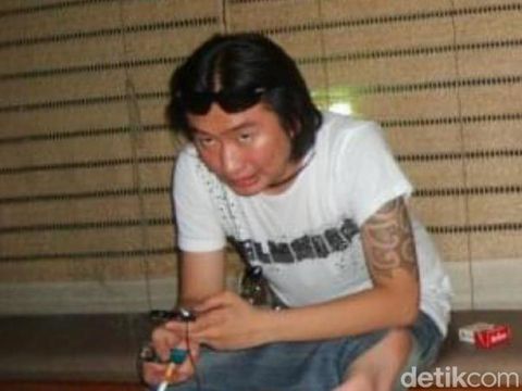 Tampang Fredy Pratama, gembong narkoba, sebelum dan sesudah operasi plastik.