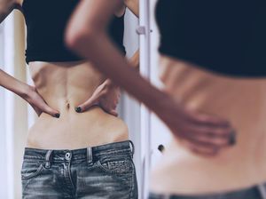 Berjuang Lawan Anoreksia, Berat Badan Wanita Ini Sempat Hanya 31 Kg