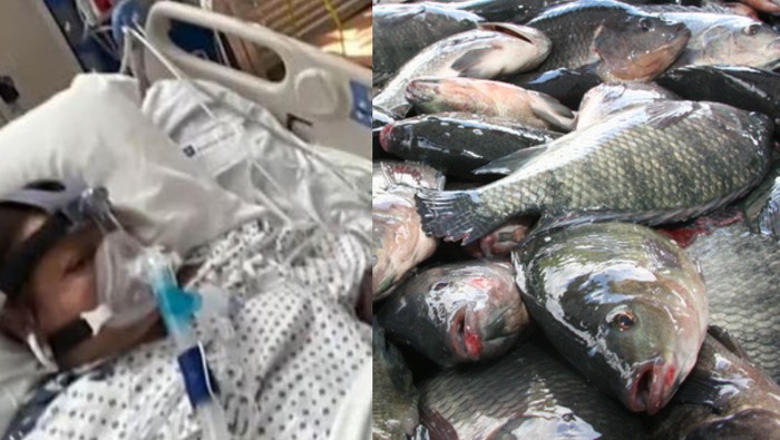 Ngeri! Wanita Ini Hampir Tewas Gegara Makan Ikan Nila