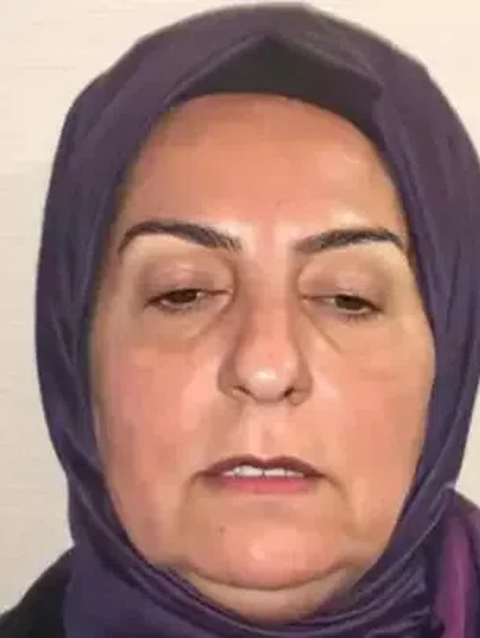 Wanita 68 tahun operasi plastik