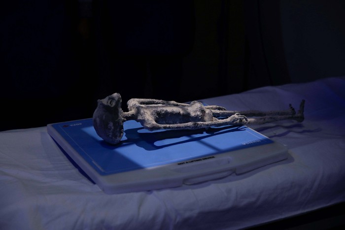 Radiologist technician Guillermo Ramirez examines an x-ray of a tiny body of a specimen, that Mexican journalist and UFO enthusiast Jaime Maussan says is not related to any known Earthly species, at Noor Clinic, in Huixquilucan, Mexico September 18, 2023. REUTERS/Raquel Cunha