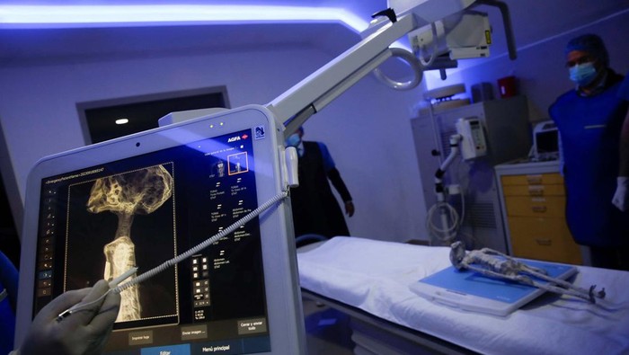 Radiologist technician Guillermo Ramirez examines an x-ray of a tiny body of a specimen, that Mexican journalist and UFO enthusiast Jaime Maussan says is not related to any known Earthly species, at Noor Clinic, in Huixquilucan, Mexico September 18, 2023. REUTERS/Raquel Cunha
