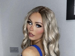Populer di Internet karena Punya Mata Juling, Model Ini Ingin Operasi Mata