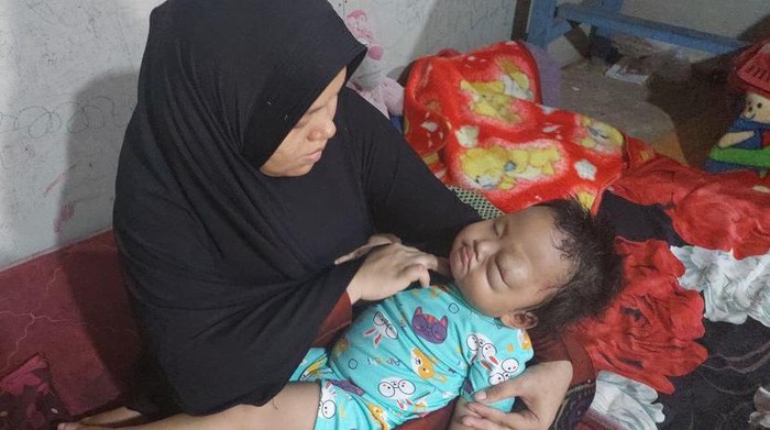 Arumi, anak penderita tumor mata bersama ibunya.