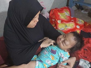 Mari Bantu Arumi, Anak Penjual Bihun Gulung Pengidap Tumor Mata