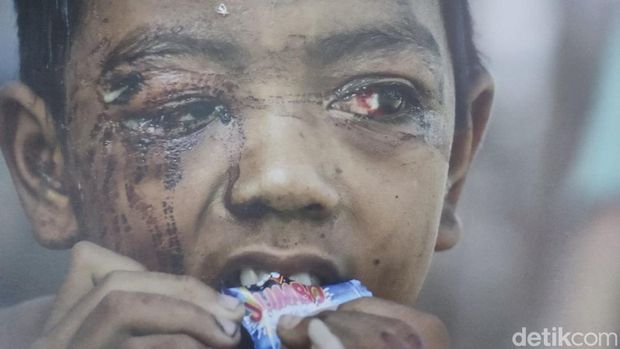 Anak korban tsunami Aceh, Desember 2004