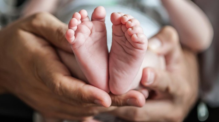 Ilustrasi Bayi Achondroplasia