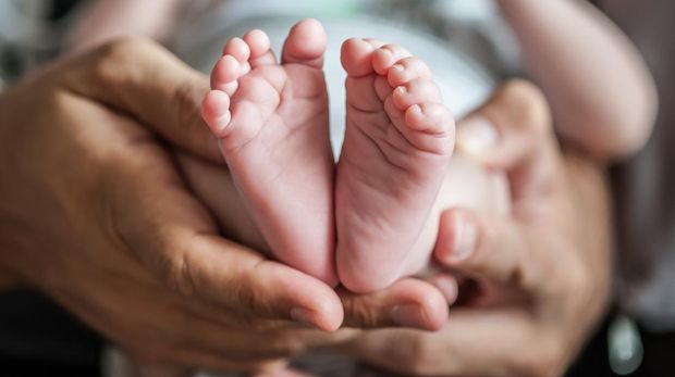 Ilustrasi Bayi Achondroplasia