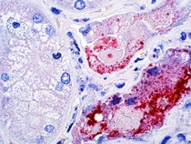 Video: Virus Nipah Berisiko Sebabkan Kematian hingga 75%