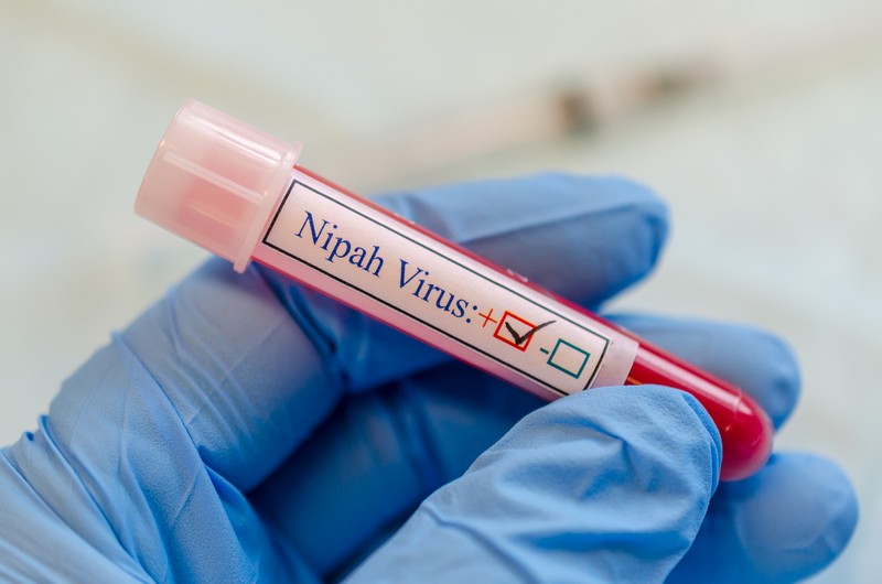 A tube contain fictitious Nipah virus contain blood