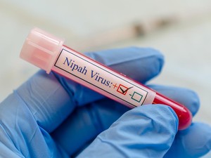 Ilmuwan China Klaim Temukan Obat yang Efektif Lawan Virus Nipah