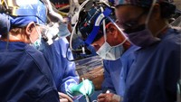 Untuk kedua kalinya di dunia, ahli bedah di Amerika Serikat melakukan cangkok jantung babi ke manusia. Penerimanya adalah seorang pasien gagal jantung yang hampir meninggal. (Foto: Dokumentasi University of Maryland Medical Center)