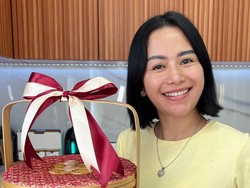 8 Foto Transformasi Farida Nurhan, 3x Oplas Hidung Kini Lepas Implan Payudara