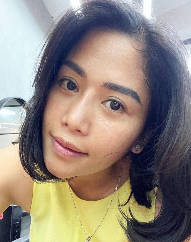 Meskipun sudah lebih mancung dan kecil, tulang hidung selebgram dengan 2,3 juta followers ini ternyata sedikit bengkok. Dia pun mengakui bahwa operasi nya itu gagal, namun tak menyesalinya. Foto: Instagram/@farida.nurhan