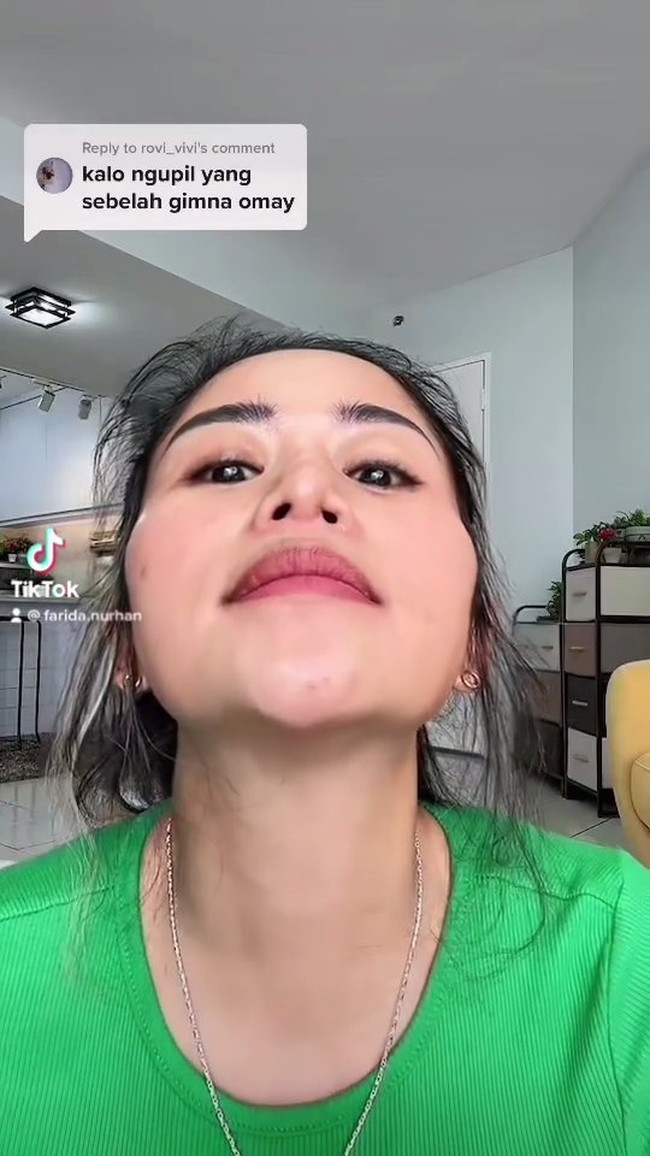 Farida Nurhan menjalani operasi hidung hingga tiga kali. Operasi pertama, lubang hidungnya tampak tidak sama. Lubang hidung kiri tampak lebih kecil daripada lubang hidung kanan. Foto: Instagram/@farida.nurhan
