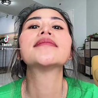 Farida Nurhan menjalani operasi hidung hingga tiga kali. Operasi pertama, lubang hidungnya tampak tidak sama. Lubang hidung kiri tampak lebih kecil daripada lubang hidung kanan. Foto: Instagram/@farida.nurhan