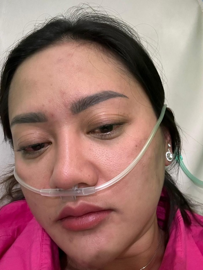 Kondisi Heni ketika mengalami reaksi alergi