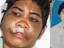 Penyiksaan TKI Asal NTT di Malaysia, Kepala Korban Retak-Muka Lebam