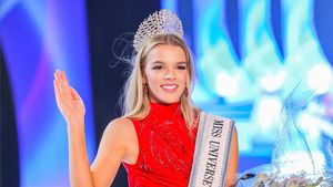 8 Potret Juara Miss Universe Zimbabwe, Jadi Kontroversi karena Berkulit Putih
