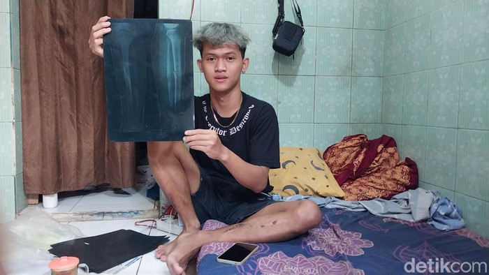 Bagas Satria 1 Tahun Kanjuruhan