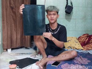 Patah Kaki Sampai Lupa Cara Lari, Bagas Tak Mau Tonton Arema FC Lagi